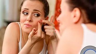 ¿Por qué el estrés produce acné y granitos en la cara?