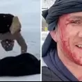 YouTube: Peleador de UFC se tiró de cabeza a un lago congelado y acabó con el hospital