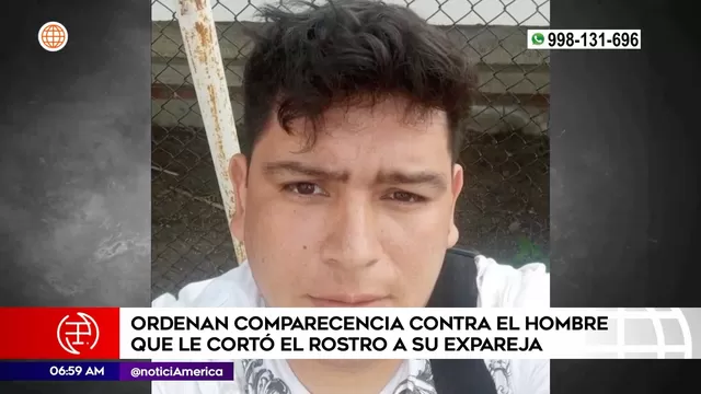 Chiclayo: Poder Judicial ordenó comparecencia a hombre que cortó el rostro a expareja