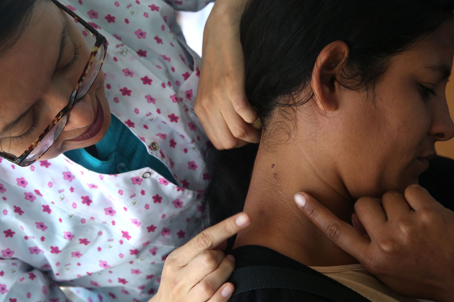 Sistema de vacunación que reduce la progresión del melanoma. Foto: Andina