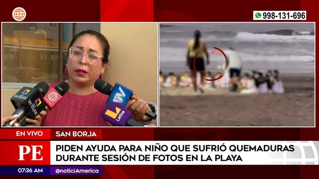 Playa Arica: Madre señala que hijo está con respiración y alimentación asistida tras quemaduras