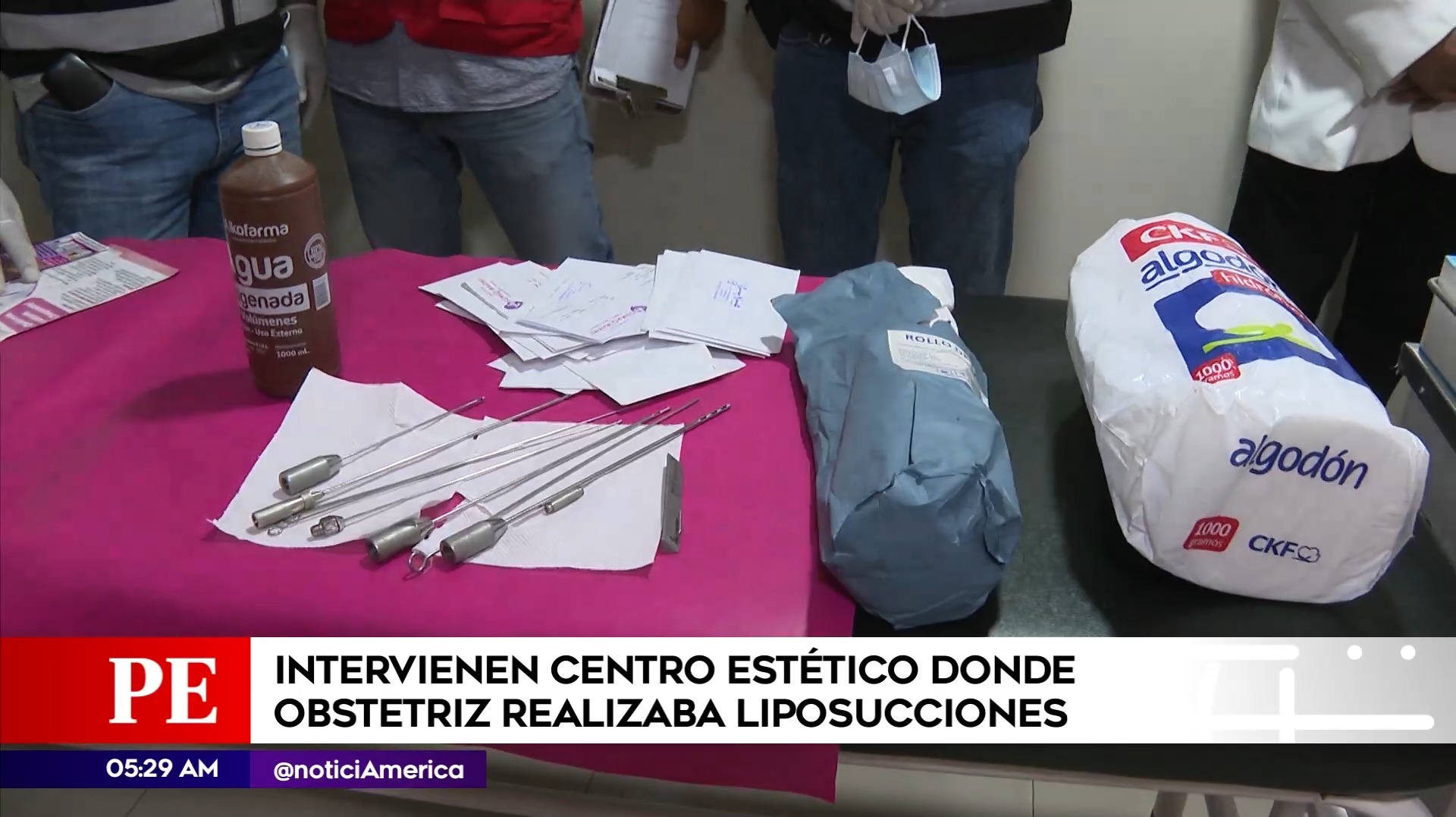Obstetriz realizaba liposucciones en San Juan de Lurigancho. Foto: América Noticias