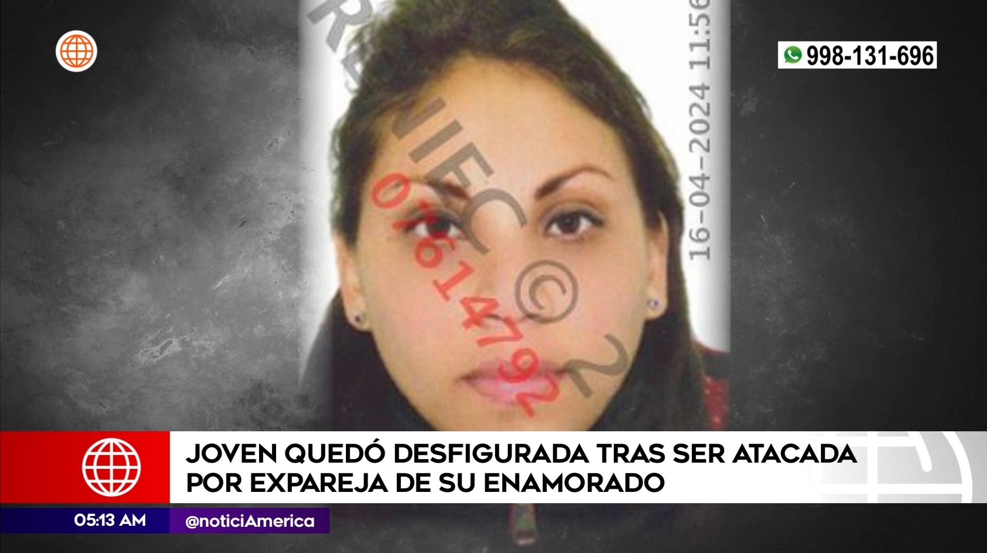 Mujer sufrió ataque en San Juan de Miraflores. Foto: América Noticias