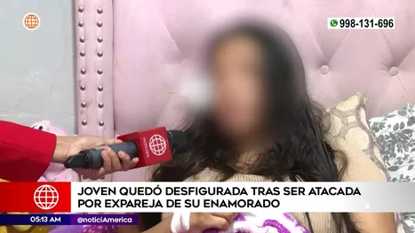 San Juan de Miraflores: Joven qued&oacute; desfigurada tras ser atacada por expareja de su enamorado