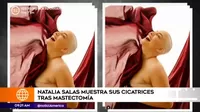 Natalia Salas compartió una fotografía que muestra la cicatriz de la mastectomía a la que se sometió