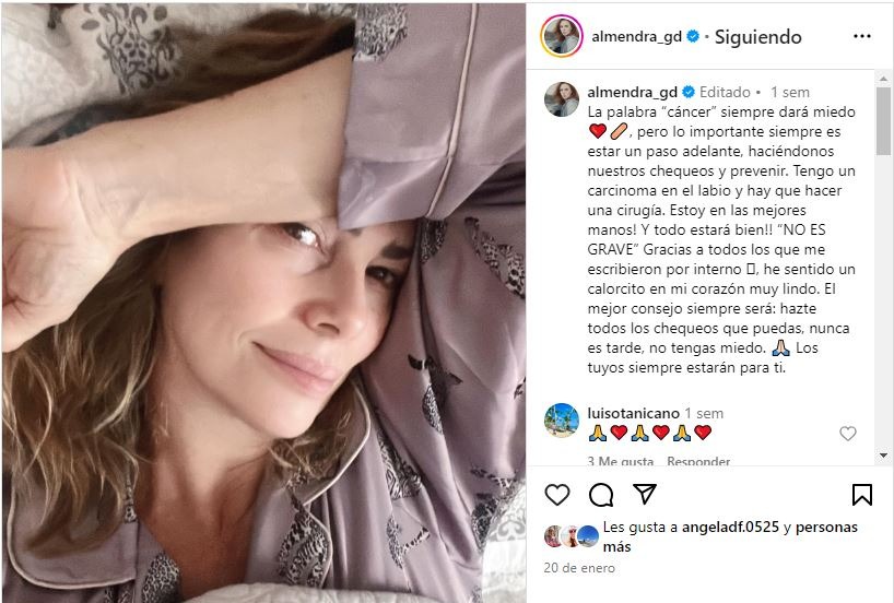 Mensaje de Instagram de Almendra Gomelsky anunciando que le diagnosticaron un carcinoma en uno de sus labios/Foto: Instagram
