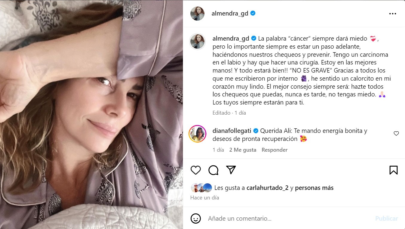 Almendra Gomelsky anunció en Instagram que se someterá a una cirugía por el cáncer que le han detectado en el labio/Foto: Instagram