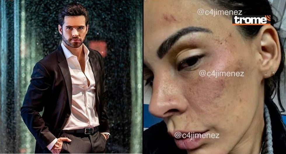 Stephanie Valenzuela fue victima de maltrato físico por parte del actor mexicano Eleazar Gómez en el 2021/Foto: Trome
