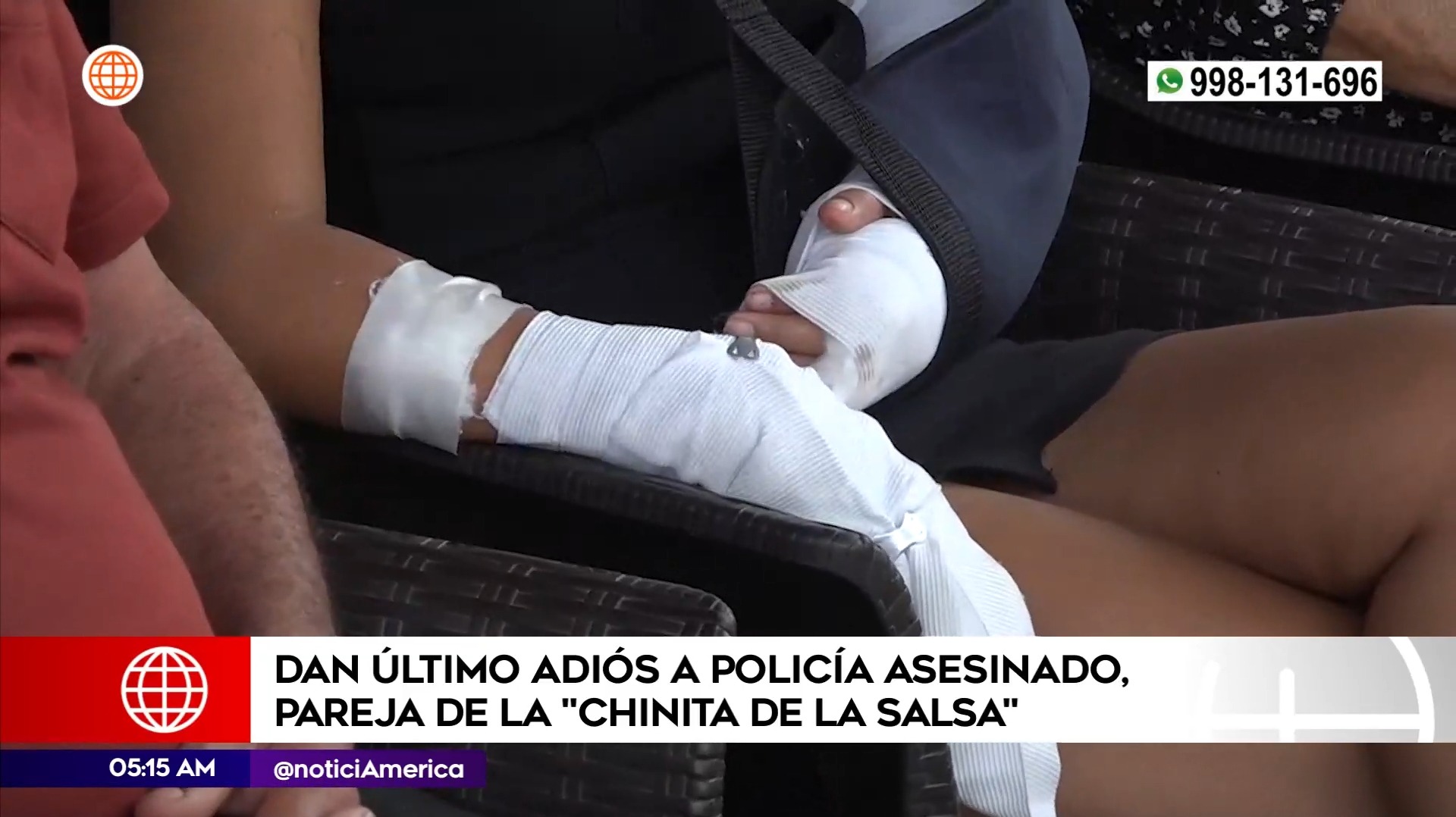 Vanessa Soto todavía tiene las balas alojadas en sus brazos tras ataque de sicarios 