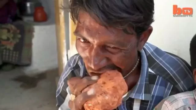 India: Hombre come a diario un ladrillo y tres kilos de barro para saciar su apetito