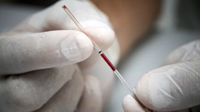 Es prematuro decir que hay una cura para el VIH, según científicos. Foto: AFP / Jody Amiet