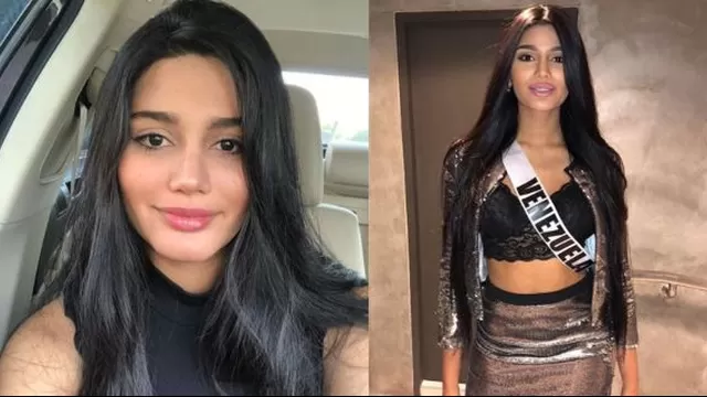 Miss Venezuela: revelan sus fotografías antes de someterse a cirugías plásticas