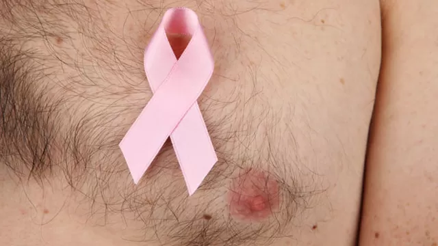 El cáncer de mama también puede darse en varones