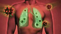 COVID-19: ¿Qué pacientes con daños pulmonares terminan en UCI?