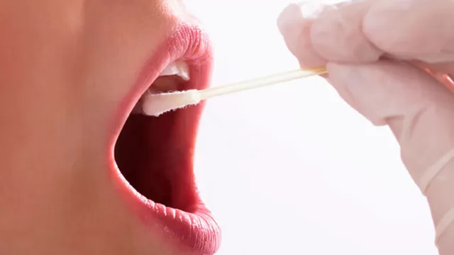 Conoce las causas de la excesiva saliva (Foto: Shutterstock)