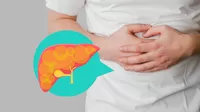 ¿Cómo luce realmente un hígado graso y qué pasa si no se trata?