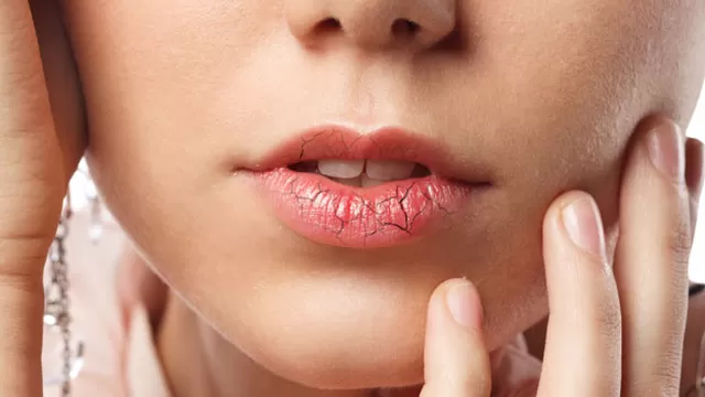 Los labios resecos están relacionados a ciertos factores más allá del clima (Foto: Shutterstock)