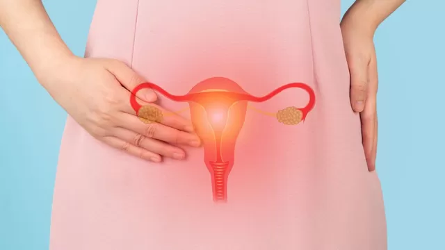 ¿Es verdad que un ovario poliquístico tiene quistes?