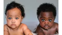 Gemelas con diferente color de piel: ¿Por qué nacen así?