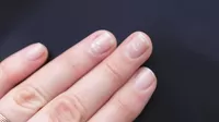 ¿Qué hábitos y accidentes te provocan manchas blancas en tus uñas?