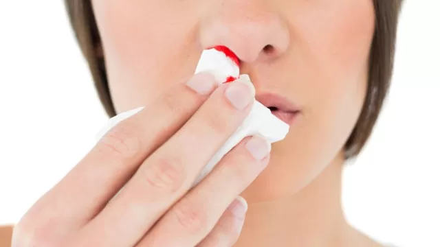 Así es como debes parar un sangrado en la nariz
