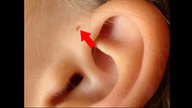 Significado de estos huequitos en las orejas