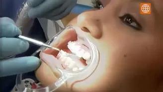 Dientes chuecos: Así funcionan los brackets en la ortodoncia