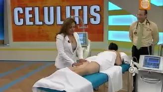 Elimina la celulitis en pierna y glúteos con este efectivo tratamiento  
