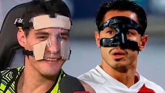 Facundo González regresó a EEG con un curioso protector facial para recuperarse.