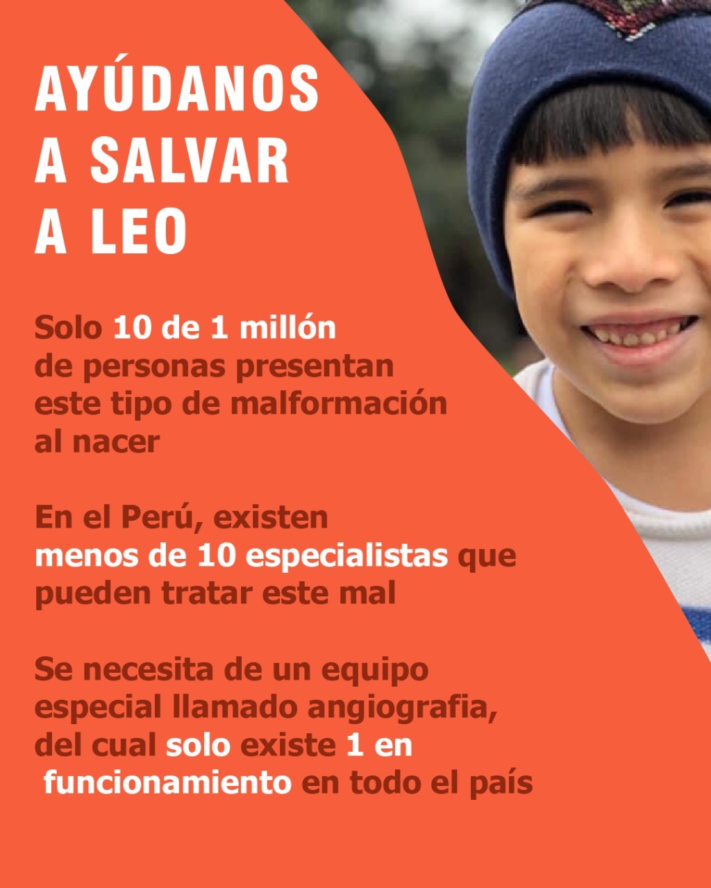 Ayudemos a salvar al pequeño Leo que sufre una malformación vascular en el cerebro