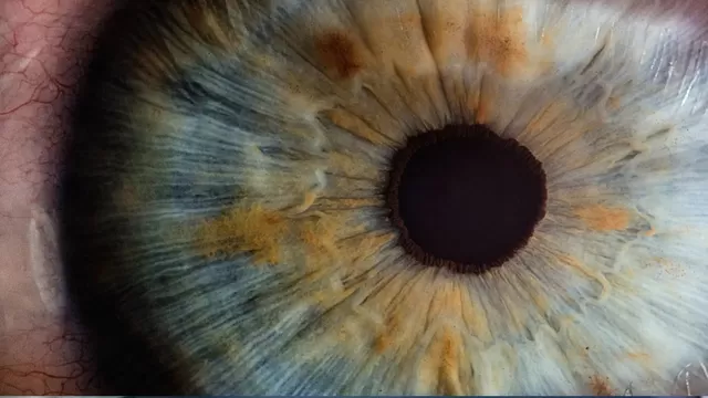 Cornea artificial logra devolver la vista a personas invidentes. Foto: ABC Salud
