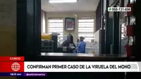 Cusco: Confirman primer caso de viruela del mono