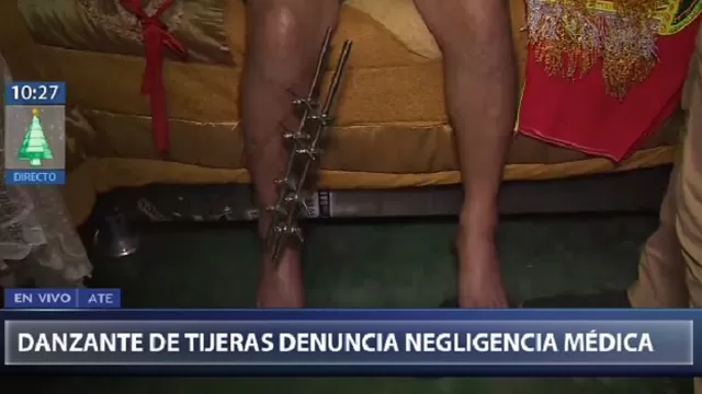 Danzante de tijeras denunció negligencia médica en el hospital Cayetano Heredia