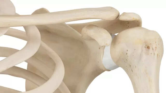Expertos desarrollan implantes óseos impresos en 3D para regenerar el hueso