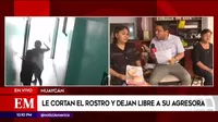 Huaycán: Mujer cortó el rostro a trabajadora de hostal al negarse a dejar habitación