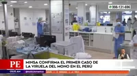 Minsa confirmó el primer caso de la viruela del mono en el Perú