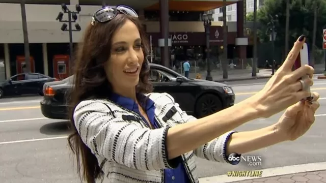 Mujer se gastó 15 mil dólares en cirugías para verse mejor en los 'selfies'