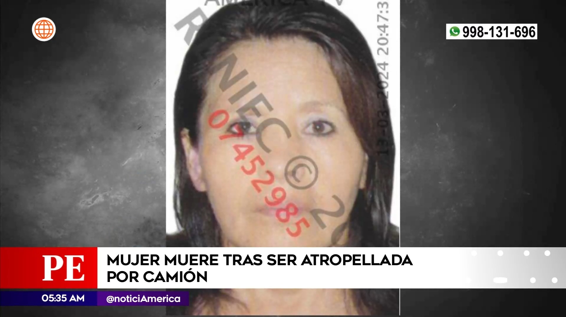 Mujer murió atropellada en Los Olivos. Foto: América Noticias