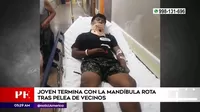 San Luis: Joven terminó con la mandíbula rota tras pelea de vecinos