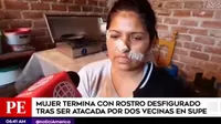 Supe: mujer termina con el rostro desfigurado tras ataque de sus vecinas