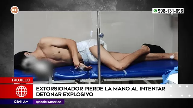 Trujillo: Extorsionador perdió la mano al intentar detonar explosivo