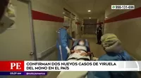 Viruela del mono: Minsa confirmó dos nuevos casos en el Perú