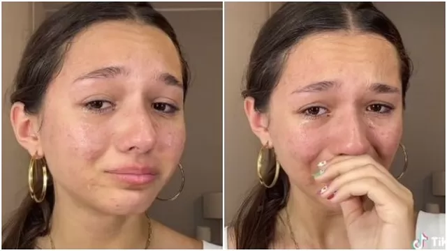 Alexia Barnechea rompió en llanto tras sufrir de acné crónico: “Hay algo que no está bien”