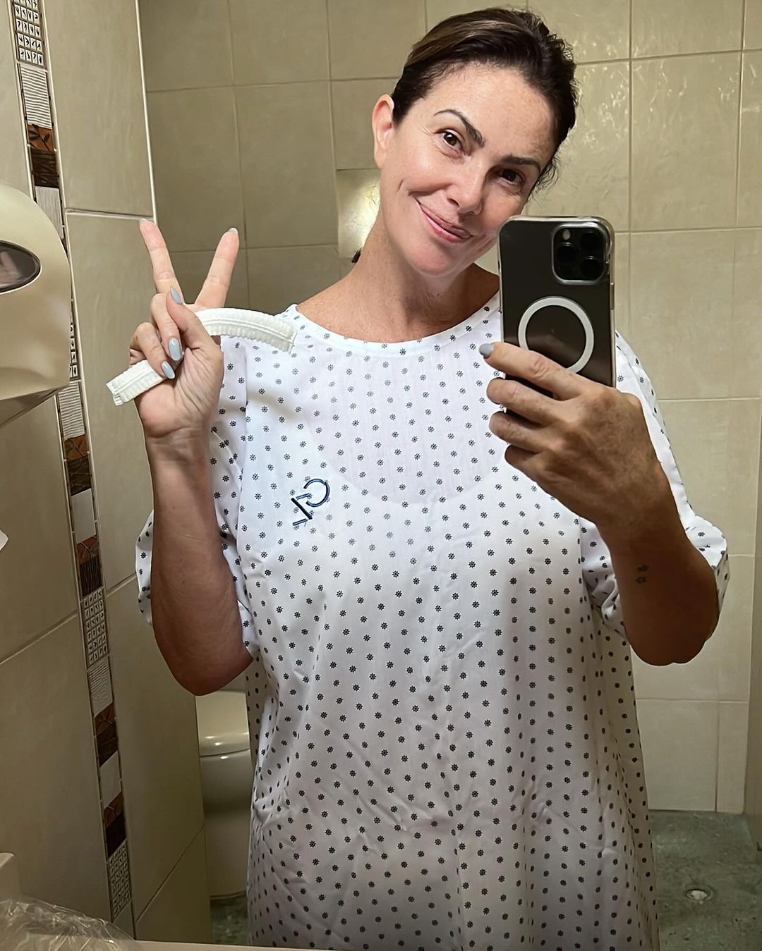 Hace 5 días Almendra Gomelsky fue sometida a una operación para extirparle un carcinoma detectado en uno de sus labios/Foto: Istagram