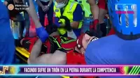 EEG: Facundo González paralizó el set del programa al sufrir preocupante lesión 