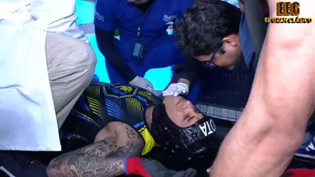 EEG: Jota Benz sufrió fuerte golpe en el rostro durante competencia con Irivarren