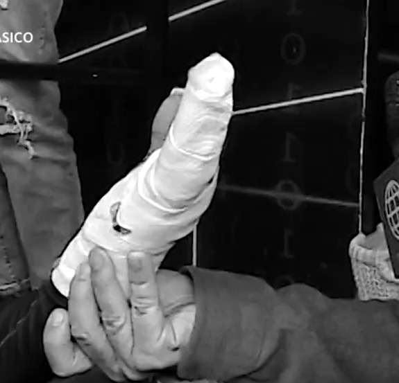 Karen Dejo sufrió accidente en la mano durante sus entrenamientos / Foto: Más Espectáculos