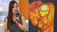 Melissa Klug mostró la ecografía de su bebé con Jesús Barco