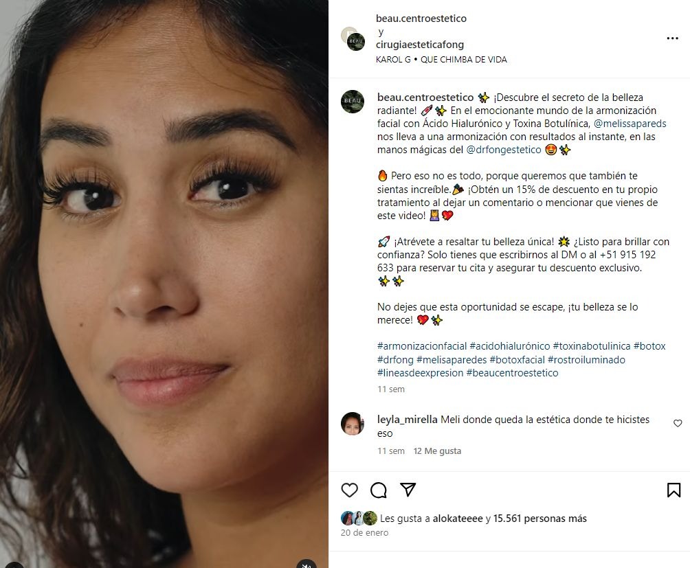 Melissa Paredes fue paciente del cuestionado doctor Fong / Instagram
