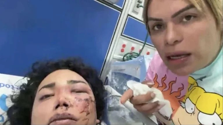 Wendy Guevara reveló estado de salud de Paolita Suárez tras ataque. Fuente: Instagram